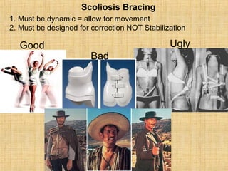 Scoliosis Bracing
1. Must be dynamic = allow for movement
2. Must be designed for correction NOT Stabilization
Good
Bad
Ugly
 