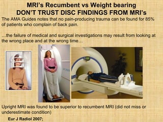 Upright MRI was found to be superior to recumbent MRI (did not miss or
underestimate condition)
Eur J Radiol 2007;
The AMA Guides notes that no pain-producing trauma can be found for 85%
of patients who complain of back pain.
…the failure of medical and surgical investigations may result from looking at
the wrong place and at the wrong time…
MRI’s Recumbent vs Weight bearing
DON’T TRUST DISC FINDINGS FROM MRI’s
 