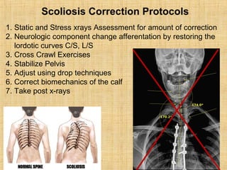 Scoliosis Correction Protocols
1. Static and Stress xrays Assessment for amount of correction
2. Neurologic component change afferentation by restoring the
lordotic curves C/S, L/S
3. Cross Crawl Exercises
4. Stabilize Pelvis
5. Adjust using drop techniques
6. Correct biomechanics of the calf
7. Take post x-rays
 