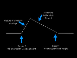 Tanner 2
0.5 cm /month Standing height
Risser 4
No change in serial height
Closure of triradiate
cartilage
Menarche
Axillary hair
Risser 1
 