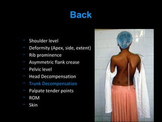 Shoulder level
Deformity (Apex, side, extent)
Rib prominence
Asymmetric flank crease
Pelvic level
Head Decompensation
Trunk Decompensation
Palpate tender points
ROM
Skin
Back
 