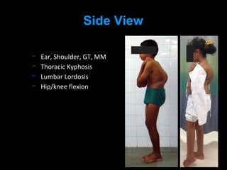 Ear, Shoulder, GT, MM
Thoracic Kyphosis
Lumbar Lordosis
Hip/knee flexion
Side View
 