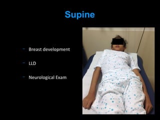 Breast development
LLD
Neurological Exam
Supine
 