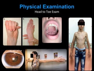 Physical Examination
Head to Toe Exam
 