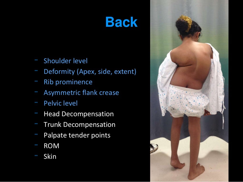 Scoliosis examination