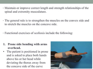 Side Shift Method Scoliosis part 2.pdf.pdftdgzzhxjvivjvicuch | PDF