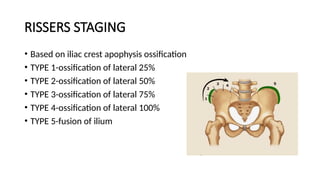 Score Riser Comprehensive Overview of Scoliosis: Anatomy, Classification, and ...