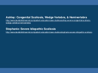 Ashley: Congenital Scoliosis, Wedge Vertebra, & Hemivertebra
http://www.davidsfeldmanmd.com/patient-education/case-studies/ashley-severe-congenital-scoliosis-
wedge-vertebra-hemivertebra
Stephanie: Severe Idiopathic Scoliosis
http://www.davidsfeldmanmd.com/patient-education/case-studies/stephanie-severe-idiopathic-scoliosis
 