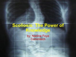Scoliosis: The Power of Knowledge by: Nadine Foye Commtech 