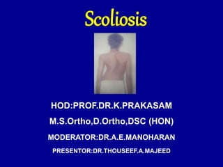 HOD:PROF.DR.K.PRAKASAM
M.S.Ortho,D.Ortho,DSC (HON)
MODERATOR:DR.A.E.MANOHARAN
PRESENTOR:DR.THOUSEEF.A.MAJEED
Scoliosis
 
