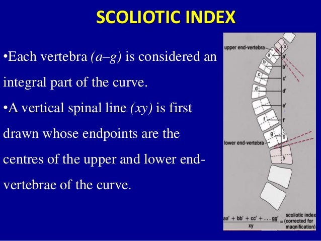 Scoliosis Curve Chart