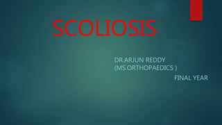 SCOLIOSIS
DR.ARJUN REDDY
(MS.ORTHOPAEDICS )
FINAL YEAR
 