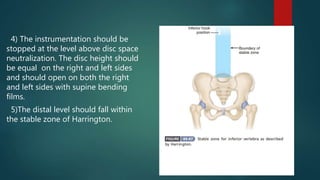 4) The instrumentation should be
stopped at the level above disc space
neutralization. The disc height should
be equal on the right and left sides
and should open on both the right
and left sides with supine bending
films.
5)The distal level should fall within
the stable zone of Harrington.
 