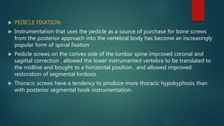  PEDICLE FIXATION:
 Instrumentation that uses the pedicle as a source of purchase for bone screws
from the posterior approach into the vertebral body has become an increasingly
popular form of spinal fixation
 Pedicle screws on the convex side of the lumbar spine improved coronal and
sagittal correction , allowed the lower instrumented vertebra to be translated to
the midline and bought to a horizontal position , and allowed improved
restoration of segmental lordosis.
 Thoracic screws have a tendency to produce more thoracic hypokyphosis than
with posterior segmental hook instrumentation.
 