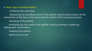  Basic steps of pedicle fixation:
1)Clearing the soft tissue
2)Exposing the cancellous bone of the pedicle canal by decortication at the
intersection of the base of the facet and the middle of the transverse process
3)probing of the pedicle
4)verifying the four walls of the pedicle canal by probing or obtaining
radiographic confirmation
5)tapping the pedicle
6)placing the screw
 