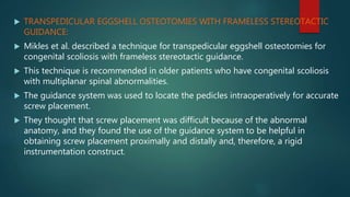  TRANSPEDICULAR EGGSHELL OSTEOTOMIES WITH FRAMELESS STEREOTACTIC
GUIDANCE:
 Mikles et al. described a technique for transpedicular eggshell osteotomies for
congenital scoliosis with frameless stereotactic guidance.
 This technique is recommended in older patients who have congenital scoliosis
with multiplanar spinal abnormalities.
 The guidance system was used to locate the pedicles intraoperatively for accurate
screw placement.
 They thought that screw placement was difficult because of the abnormal
anatomy, and they found the use of the guidance system to be helpful in
obtaining screw placement proximally and distally and, therefore, a rigid
instrumentation construct.
 
