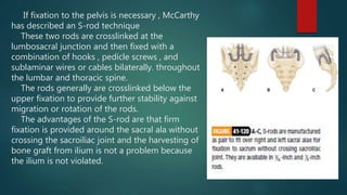 If fixation to the pelvis is necessary , McCarthy
has described an S-rod technique
These two rods are crosslinked at the
lumbosacral junction and then fixed with a
combination of hooks , pedicle screws , and
sublaminar wires or cables bilaterally. throughout
the lumbar and thoracic spine.
The rods generally are crosslinked below the
upper fixation to provide further stability against
migration or rotation of the rods.
The advantages of the S-rod are that firm
fixation is provided around the sacral ala without
crossing the sacroiliac joint and the harvesting of
bone graft from ilium is not a problem because
the ilium is not violated.
 