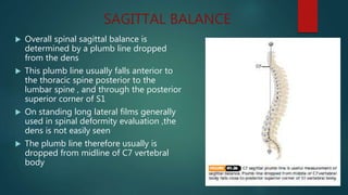SAGITTAL BALANCE
 Overall spinal sagittal balance is
determined by a plumb line dropped
from the dens
 This plumb line usually falls anterior to
the thoracic spine posterior to the
lumbar spine , and through the posterior
superior corner of S1
 On standing long lateral films generally
used in spinal deformity evaluation ,the
dens is not easily seen
 The plumb line therefore usually is
dropped from midline of C7 vertebral
body
 