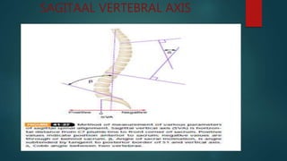 SAGITAAL VERTEBRAL AXIS
 
