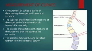MEASUREMENT OF CURVES
 Measurement of curves is based on
determining the upper and lower end
vertebra
 The superior end vertebra is the last one at
the upper end of the curve that tilts
towards the concavity
 The inferior end vertebra is the last one at
the lower end that tilts towards the
concavity
 The apical vertebra is the one deviated
farthest from the vertebral column
 