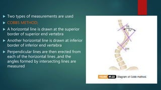  Two types of measurements are used
 COBBS METHOD;
 A horizontal line is drawn at the superior
border of superior end vertebra
 Another horizontal line is drawn at inferior
border of inferior end vertebra
 Perpendicular lines are then erected from
each of the horizontal lines ,and the
angles formed by intersecting lines are
measured
 