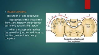  RISSER GRADING
(Excursion of Iliac apophysis)
ossification of the crest of the
ilium starts laterally and proceeds
posteriorly towards the sacrum
when the apophysis reaches
the sacro iliac junction and fuses to
the ilium,maturation is nearly
complete
 