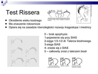 Score Riser Scolosis | PPT