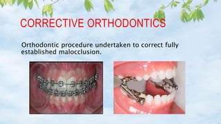 CORRECTIVE ORTHODONTICS
Orthodontic procedure undertaken to correct fully
established malocclusion.
 