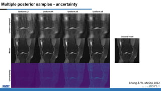 Multiple posterior samples - uncertainty
12 / 45
Chung & Ye. MeDIA 2022
 