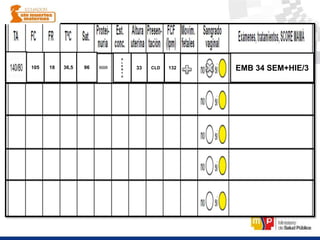 105 18 36,5 96
A
L
E
R
T
A
33 CLD 132 EMB 34 SEM+HIE/3
 