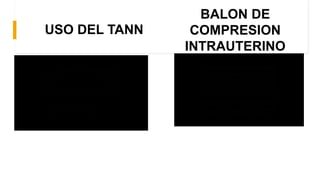 USO DEL TANN
BALON DE
COMPRESION
INTRAUTERINO
 