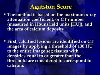 • The method is based on the maximum x-ray
attenuation coefficient, or CT number
(measured in Hounsfield units [HU]), and
the area of calcium deposits.
• First, calcified lesions are identified on CT
images by applying a threshold of 130 HU
to the entire image set; tissues with
densities equal to or greater than the
threshold are considered to correspond to
calcium.
Agatston Score
Agatston Score
 