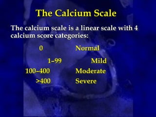 The Calcium Scale
The Calcium Scale
The calcium scale is a linear scale with 4
The calcium scale is a linear scale with 4
calcium score categories:
calcium score categories:
0
0 Normal
Normal
1–99
1–99 Mild
Mild
100–400
100–400 Moderate
Moderate
>400
>400 Severe
Severe
 