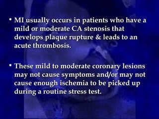 • MI usually occurs in patients who have a
MI usually occurs in patients who have a
mild or moderate CA stenosis that
mild or moderate CA stenosis that
develops plaque rupture & leads to an
develops plaque rupture & leads to an
acute thrombosis.
acute thrombosis.
• These mild to moderate coronary lesions
These mild to moderate coronary lesions
may not cause symptoms and/or may not
may not cause symptoms and/or may not
cause enough ischemia to be picked up
cause enough ischemia to be picked up
during a routine stress test.
during a routine stress test.
 