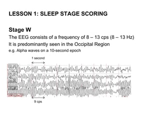 LESSON 1: SLEEP STAGE SCORING

Stage W
The EEG consists of a frequency of 8 – 13 cps (8 – 13 Hz)
It is predominantly seen in the Occipital Region
e.g. Alpha waves on a 10-second epoch
           1 second




             9 cps
 