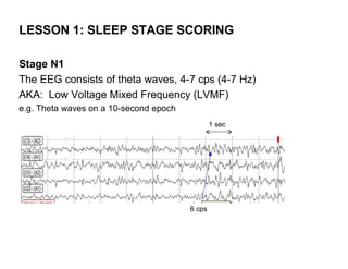 LESSON 1: SLEEP STAGE SCORING

Stage N1
The EEG consists of theta waves, 4-7 cps (4-7 Hz)
AKA: Low Voltage Mixed Frequency (LVMF)
e.g. Theta waves on a 10-second epoch
                                                1 sec




                                        6 cps
 