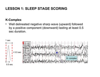 LESSON 1: SLEEP STAGE SCORING


K-Complex
• Well delineated negative sharp wave (upward) followed
  by a positive component (downward) lasting at least 0.5
  sec duration.

1 sec




          > 0.5 sec

                                            K- complex


0.5 sec
 