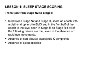 LESSON 1: SLEEP STAGE SCORING
Transition from Stage N2 to Stage R

• In between Stage N2 and Stage R, score an epoch with
  a distinct drop in chin EMG and in the first half of the
  epoch to the level seen in Stage R as Stage R if all of
  the following criteria are met, even in the absence of
  rapid eye movements.
• Absence of non-arousal associated K-complexes
• Absence of sleep spindles
 