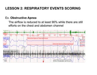 LESSON 2: RESPIRATORY EVENTS SCORING

Ex. Obstructive Apnea
  The airflow is reduced to at least 90% while there are still
  efforts on the chest and abdomen channel
 