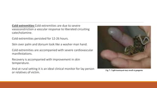 Cold extremities Cold extremities are due to severe
vasoconstriction a vascular response to liberated circuiting
catecholamine.
Cold extremities persisted for 12-26 hours.
Skin over palm and dorsum look like a washer man hand.
Cold extremities are accompanied with severe cardiovascular
manifestations.
Recovery is accompanied with improvement in skin
temperature.
And at rural setting it is an ideal clinical monitor for lay person
or relatives of victim.
 