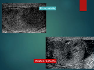 Scortal Ultrasound | PPTX