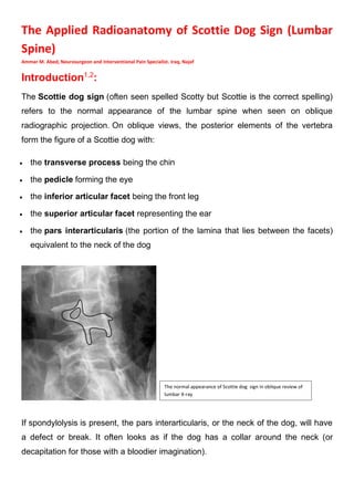 The Applied Radioanatomy of Scottie Dog Sign (Lumbar
Spine)
Ammar M. Abed, Neurosurgeon and Interventional Pain Specialist. Iraq, Najaf
Introduction1,2
:
The Scottie dog sign (often seen spelled Scotty but Scottie is the correct spelling)
refers to the normal appearance of the lumbar spine when seen on oblique
radiographic projection. On oblique views, the posterior elements of the vertebra
form the figure of a Scottie dog with:
• the transverse process being the chin
• the pedicle forming the eye
• the inferior articular facet being the front leg
• the superior articular facet representing the ear
• the pars interarticularis (the portion of the lamina that lies between the facets)
equivalent to the neck of the dog
If spondylolysis is present, the pars interarticularis, or the neck of the dog, will have
a defect or break. It often looks as if the dog has a collar around the neck (or
decapitation for those with a bloodier imagination).
The normal appearance of Scottie dog sign in oblique review of
lumbar X-ray
 