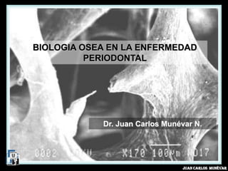 BIOLOGIA OSEA EN LA ENFERMEDAD
          PERIODONTAL




            Dr. Juan Carlos Munévar N.




                                Juan Carlos Munévar
 