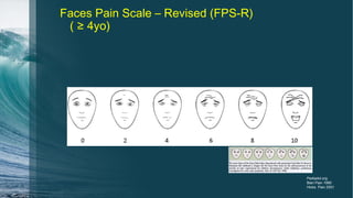 Faces Pain Scale – Revised (FPS-R)
( ≥ 4yo)
Pediadol.org
Bieri Pain 1990
Hicks Pain 2001
 