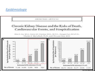 Epidémiologie
 
