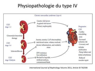 Physiopathologie du type IV
International Journal of Nephrology Volume 2011, Article ID 762590
 