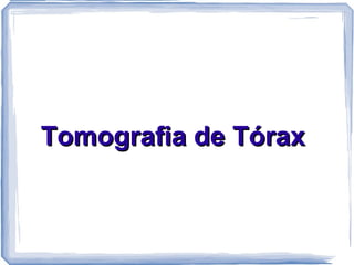 Tomografia de Tórax
 