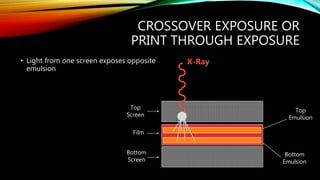 CROSSOVER EXPOSURE OR
PRINT THROUGH EXPOSURE
• Light from one screen exposes opposite
emulsion
Top
Screen
Bottom
Screen
Bottom
Emulsion
Top
Emulsion
Film
X-Ray
 