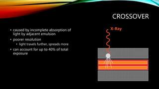 CROSSOVER
• caused by incomplete absorption of
light by adjacent emulsion
• poorer resolution
• light travels further, spreads more
• can account for up to 40% of total
exposure
X-Ray
 