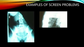 EXAMPLES OF SCREEN PROBLEMS
 